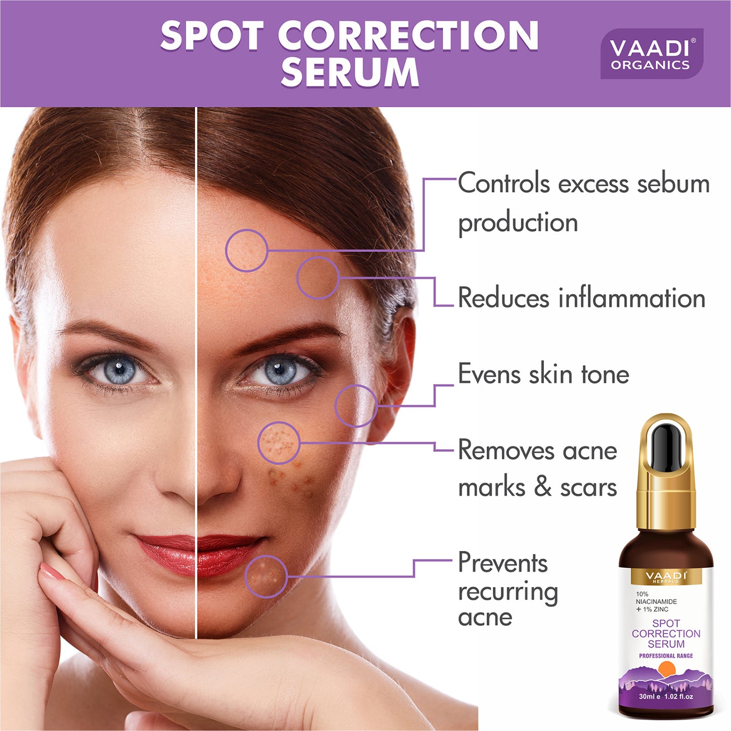 Spot Correction Serum With 10 % Niacinamide & 1% Zinc (30 ml)