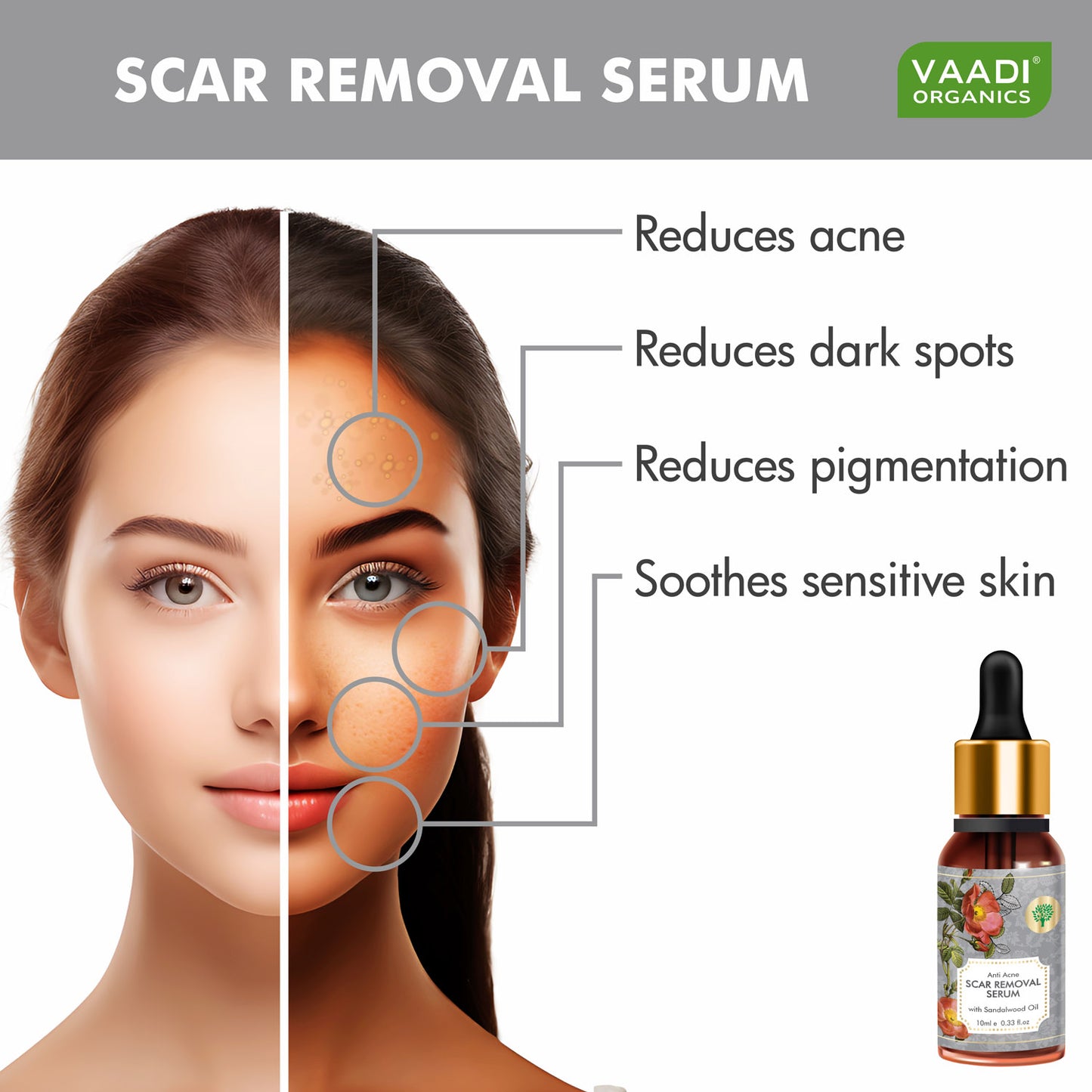 Pack of 2 Scar Removal Serum (Pure Mix of Sandalwood Oil, Steam Distilled Neem & Fenugreek Extract) - Reduces Acne, Dark Spots & Pigmentation (2 x 10 ml)