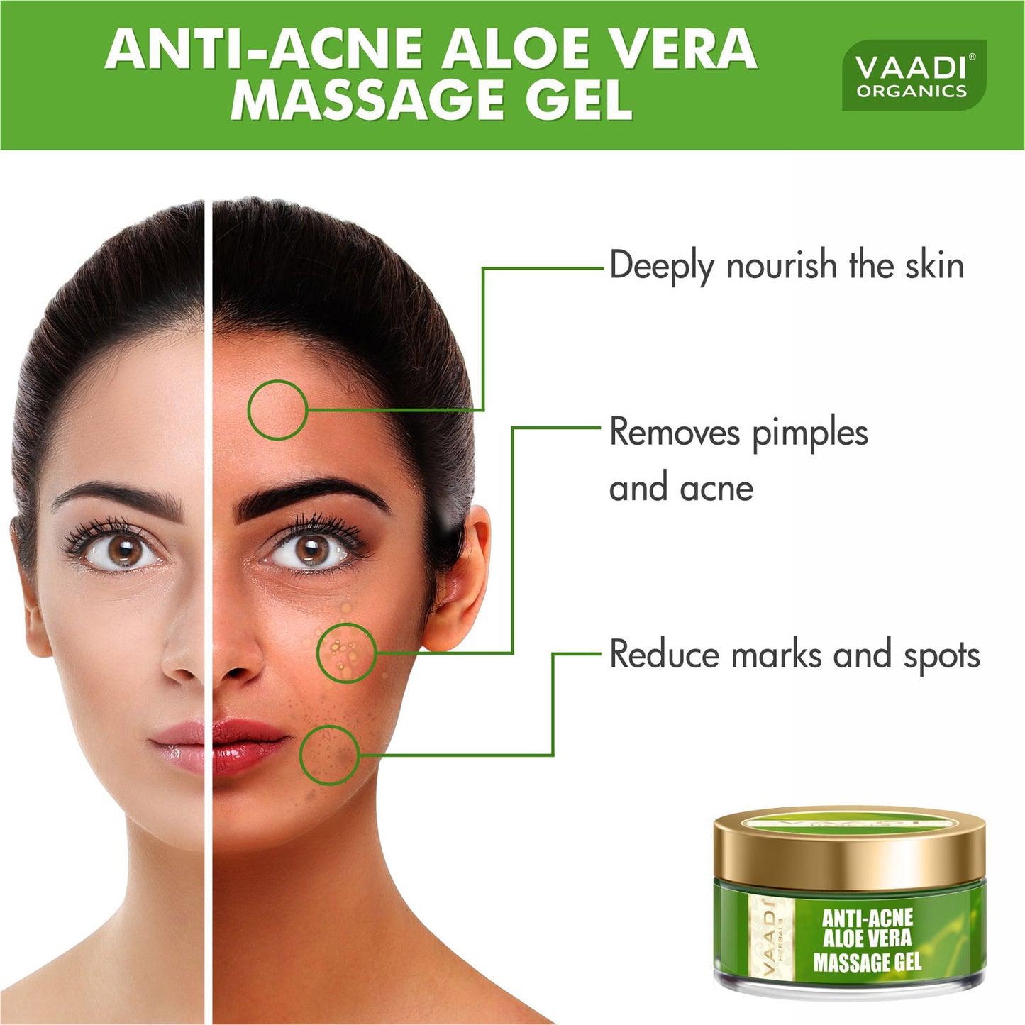 Anti-Acne Aloe Vera Massage Gel (50 gms)