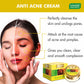 Anti-Acne Cream - Clove & Neem extract (30 gms)