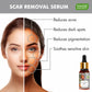 Scar Removal Serum (Pure Mix of Sandalwood Oil, Steam Distilled Neem & Fenugreek Extract) - Reduces Acne, Dark Spots & Pigmentation (10 ml)