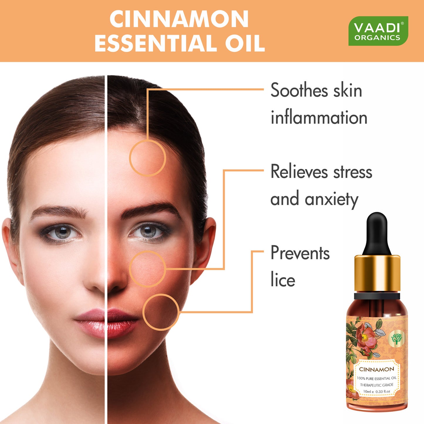 Cinnamon Essential Oil - Soothes Skin Inflammation, Relieves Stress & Anxiety & Improves Concentration - 100% Pure Therapeutic Grade (10 ml)