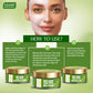 Anti-Acne Aloe Vera Facial Kit with Green Tea Extract (270 gms)