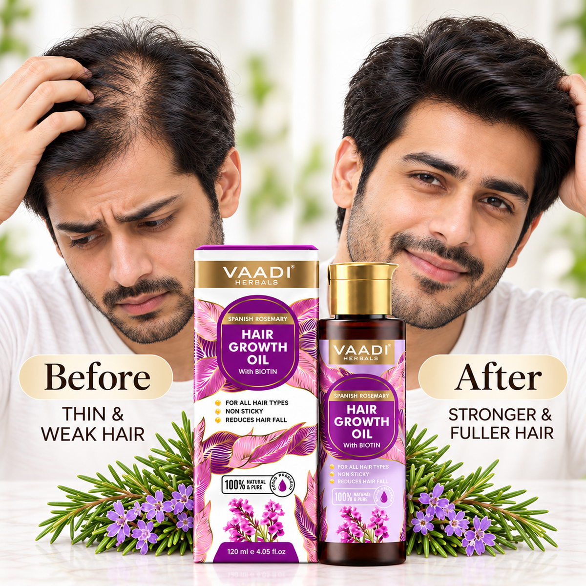 Spanish Rosemary Hair Growth Oil with Biotin-Promotes Hair Growth- Reduces Hair Fall-Strong Hair- Prevents Dandruff- For All Hair Types- 120ml
