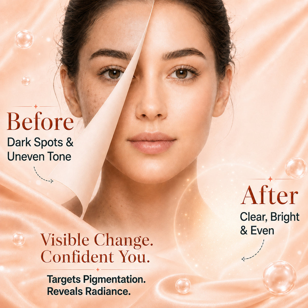 3%Tranexamic and 10% Azelaic Acid Anti Pigmentation Serum with 5% Niacinamide| Brighter Complexion| Reduces Dark Spots| Soothes Inflammation|Fades Hyper pigmentation| For All Skin Types|  ( 30 ml )