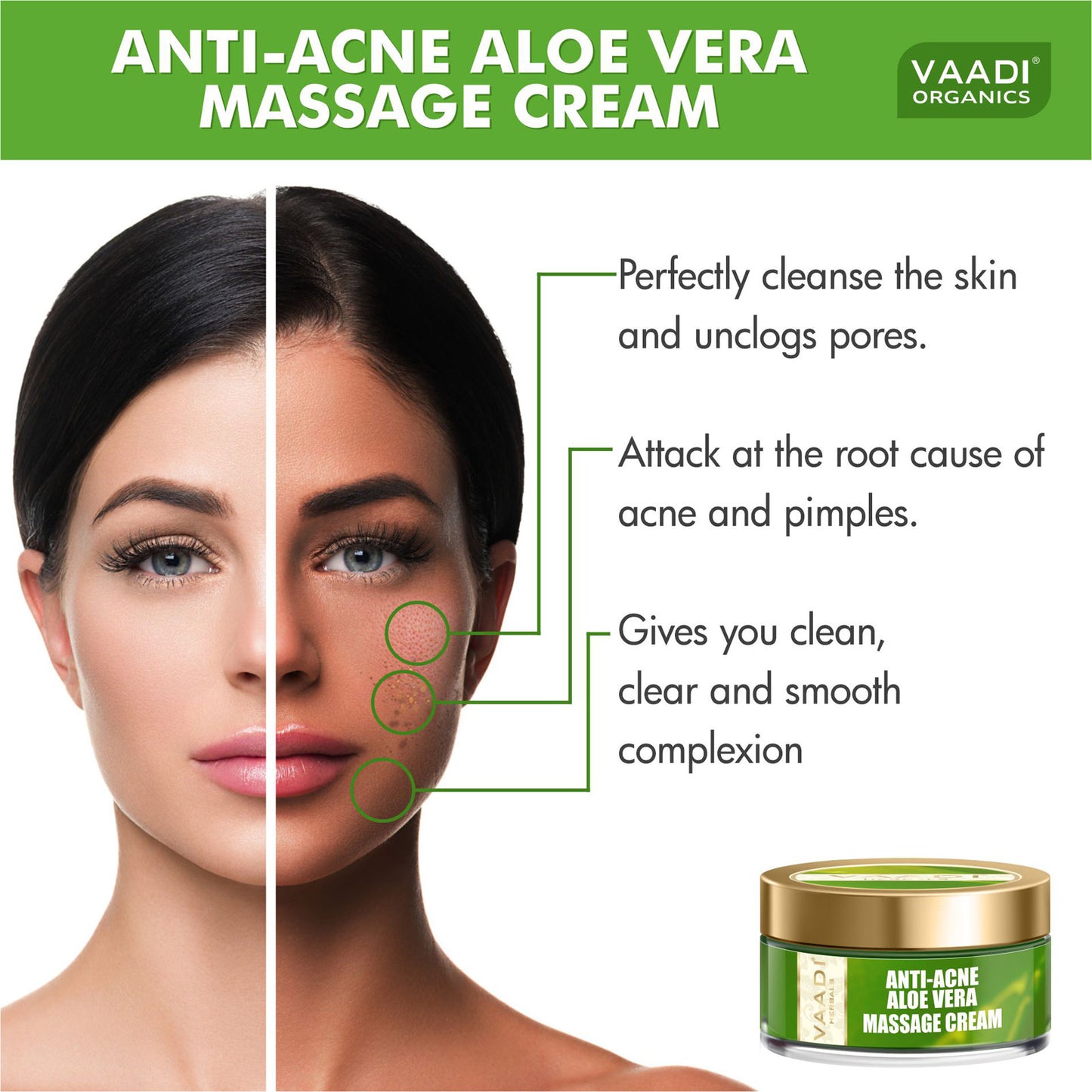 Anti-Acne Aloe Vera Massage Cream (50 gms)