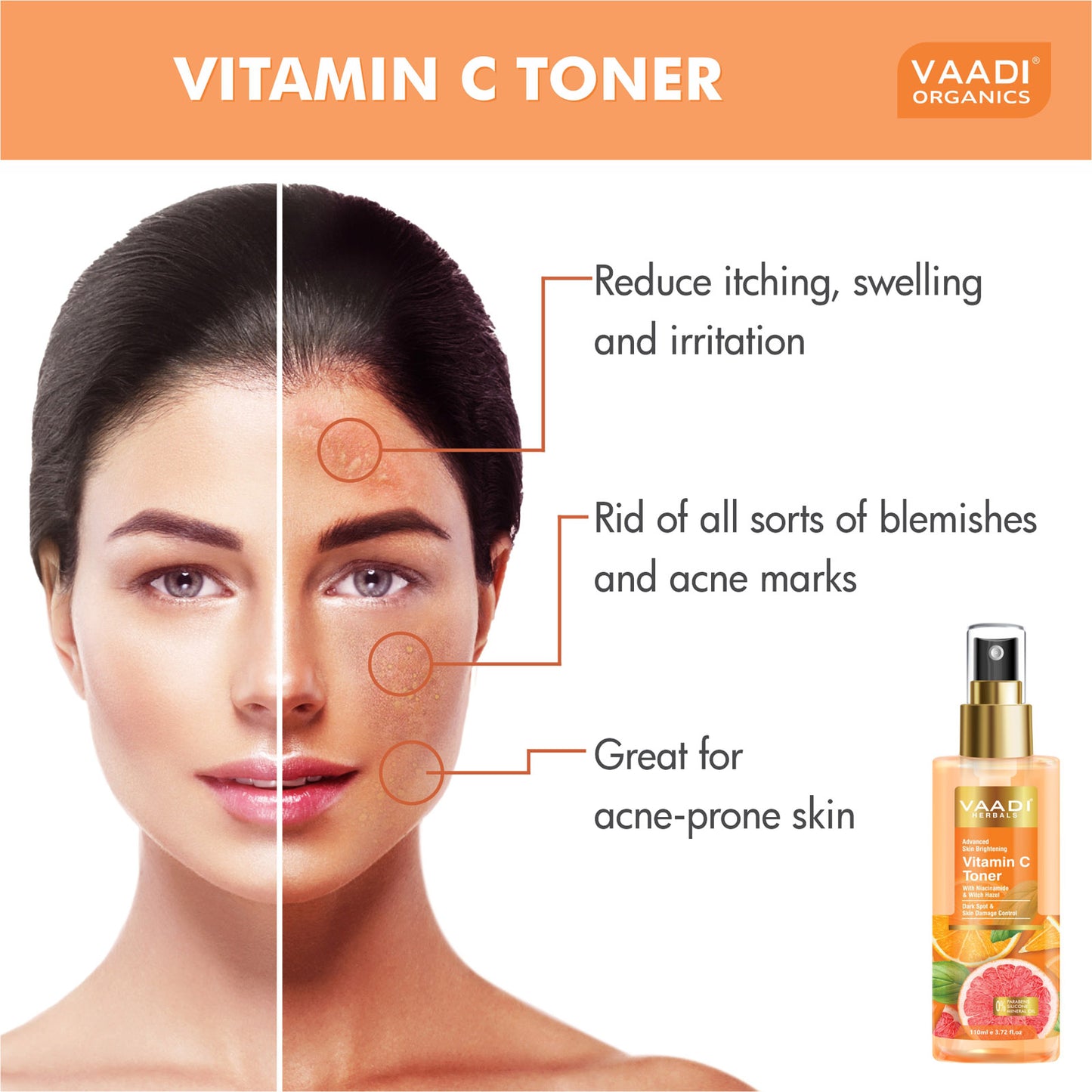 Vitamin C Toner with Niacinamide & Witch Hazel - Dark Spot & Skin Damage Control (110 ml)