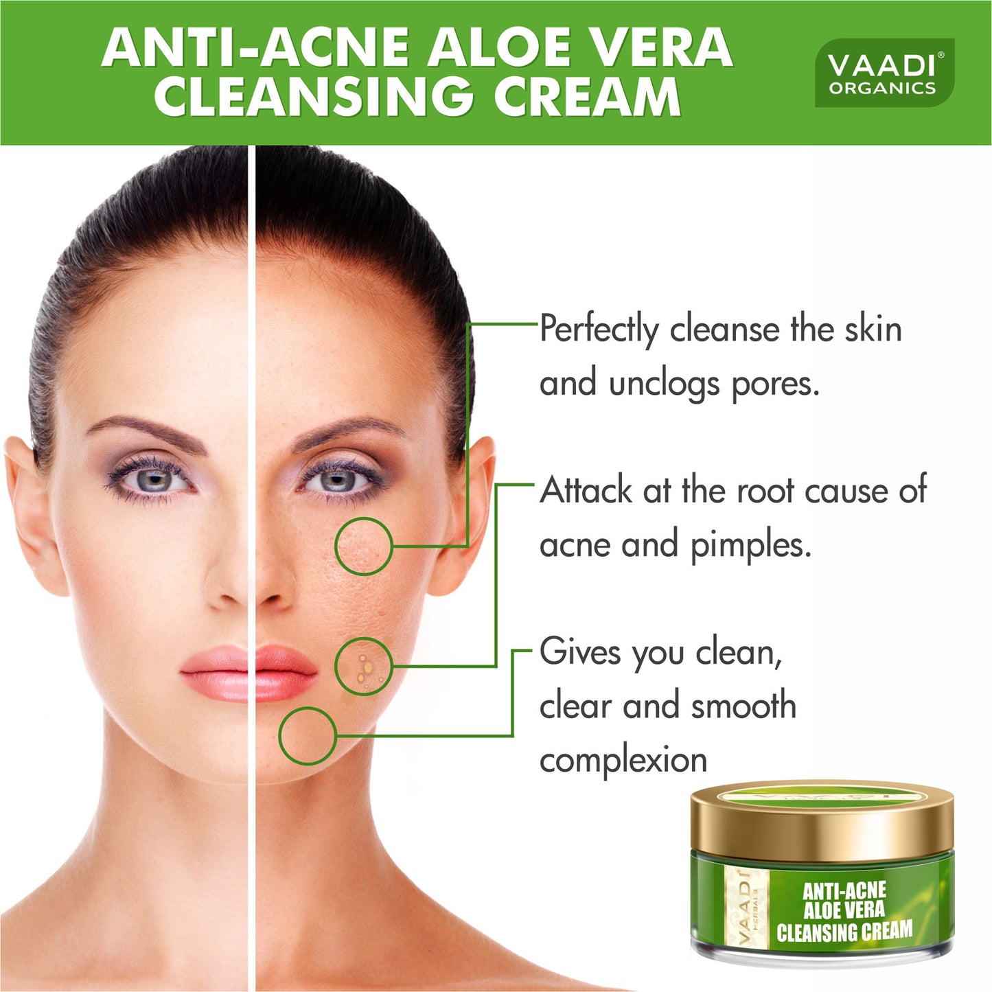 Anti-Acne Aloe Vera Cleansing Cream (50gms)