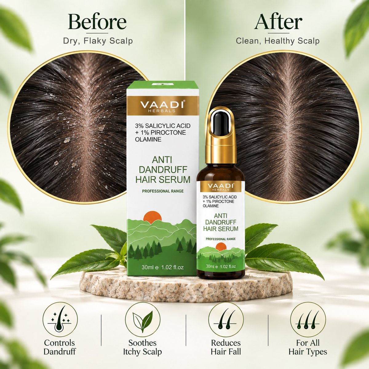 3% SALICYLIC ACID + 1% PIROCTONE OLAMINE ANTI DANDRUFF HAIR SERUM (30 ml)